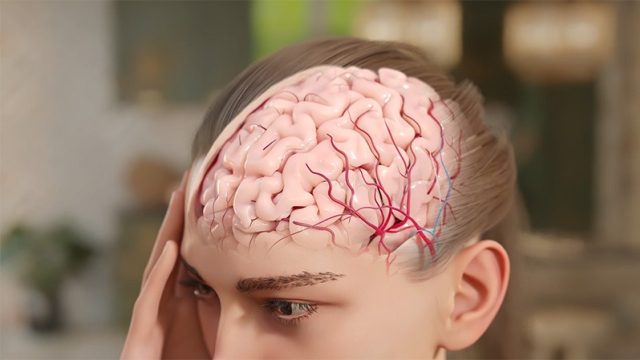 3D animated film — Eptinezumab