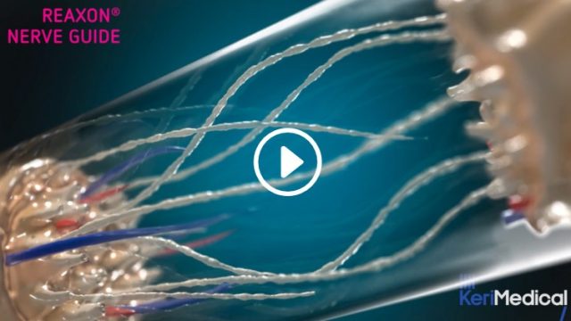 3D animated film — KeriMedical