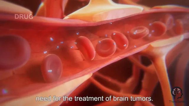 3D animated film — M2CARE- Therasonic