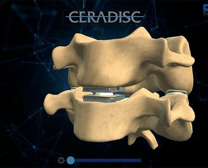 Touchscreen application — CERADISC presentation app
